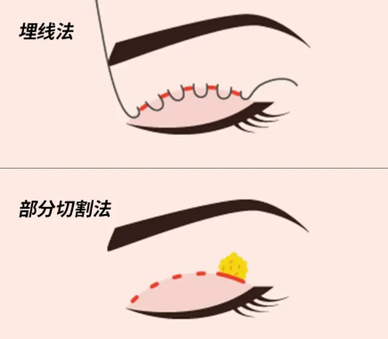 價(jià)格因素考量