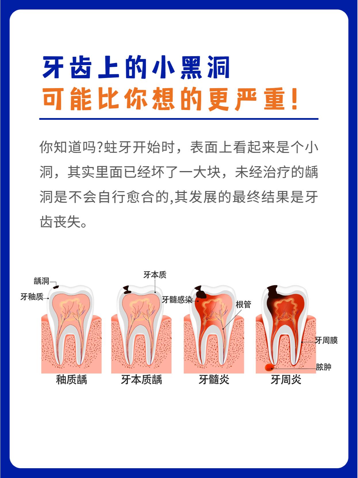 香港大学深圳医院种植牙类收费