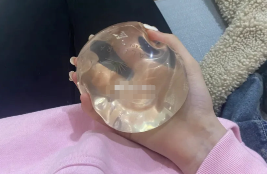 黃名斗做胸技術怎么樣：臨床經(jīng)驗與榮譽