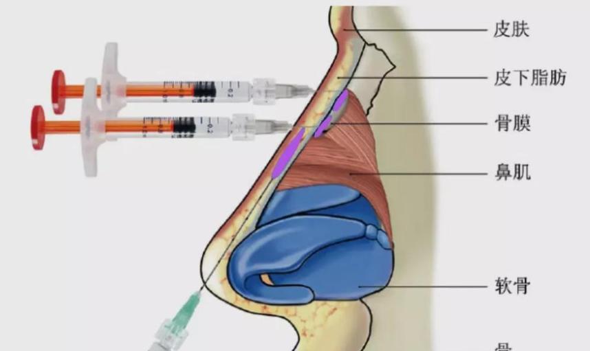 五、潛在風(fēng)險(xiǎn)與不適宜人群www.sorencai.cn