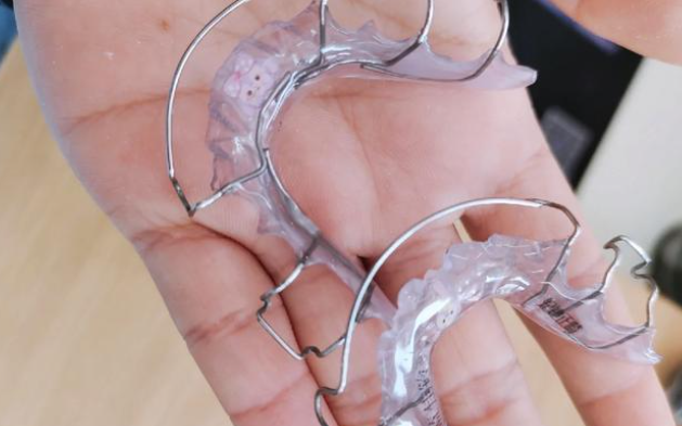 二、全口保持器的特點(diǎn)有哪些