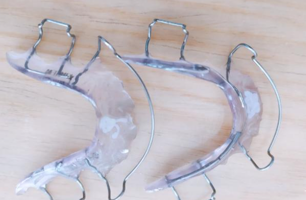 三、全口保持器有哪些種類