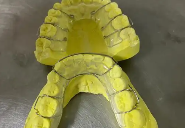 五、全口保持器的價(jià)格受哪些因素影響