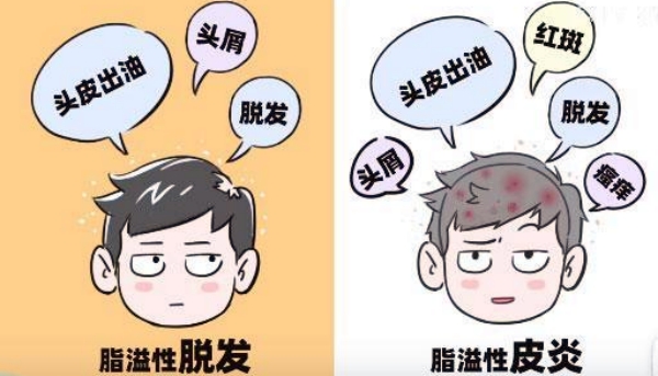 二、不同植發(fā)技術(shù)下，1500單位的價格對比