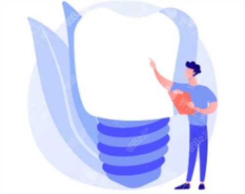 種植牙科普知識(shí)圖