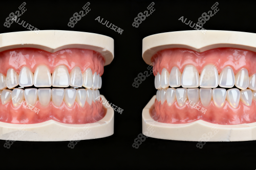 牙齒模型展示圖