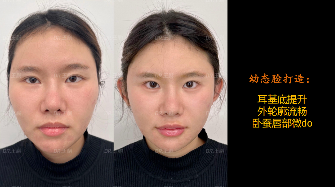 五、鼻部整形項(xiàng)目?jī)r(jià)格表