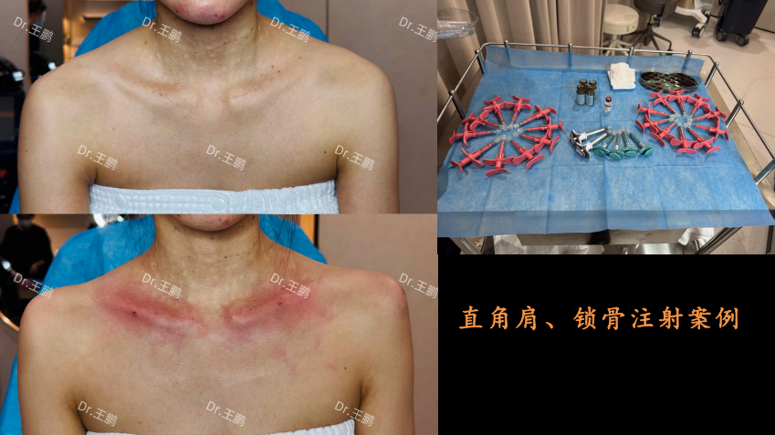 七、如何預(yù)約西安交大一附院美容科？