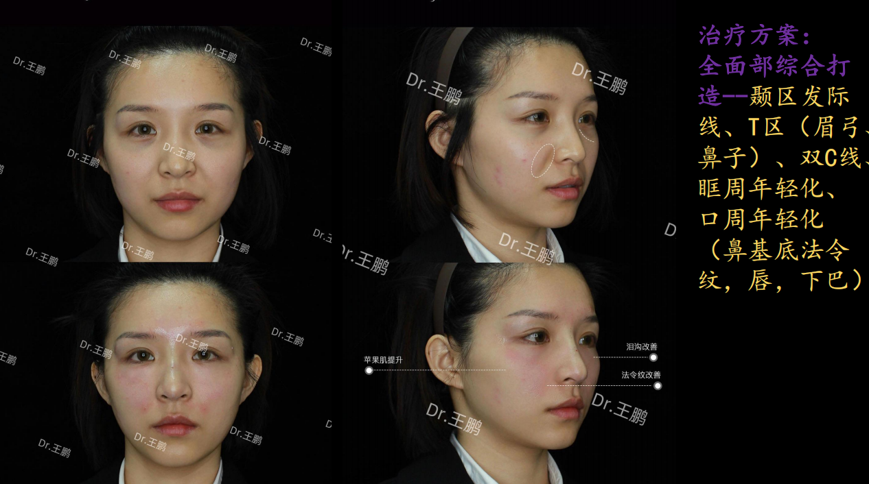 八、2026年求美趨勢(shì)與醫(yī)生推薦總結(jié)