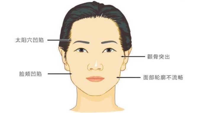 濰坊抽脂減肥價格差異大？單部位5000起，全身7萬起，多醫(yī)院價格參考——濰坊市益都中 心醫(yī)院整形科