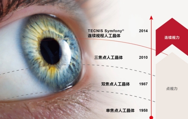 二、區(qū)域折射多焦人工晶體價(jià)格影響因素深度剖析