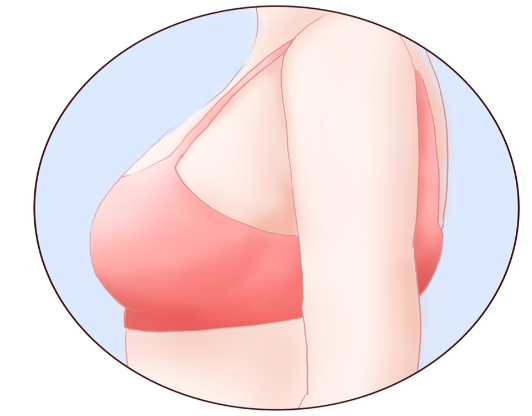 術(shù)前設(shè)計(jì)：量身定制你的黃金胸型