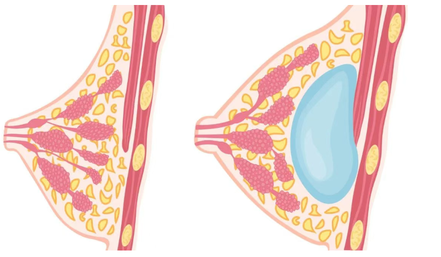 二、關(guān)于廣州美萊蒙喜永醫(yī)生收費(fèi)，這幾點(diǎn)要了解
