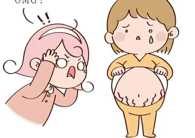 点阵激光去妊娠纹效果好