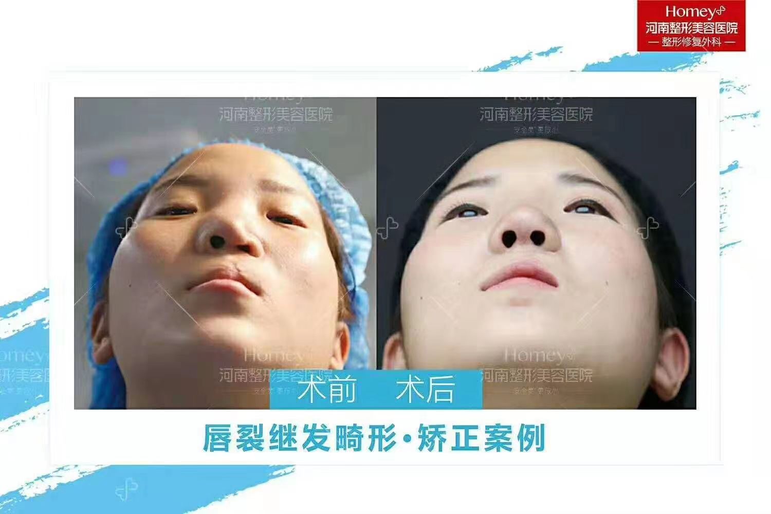 多類患者可申請，滿足不同需求