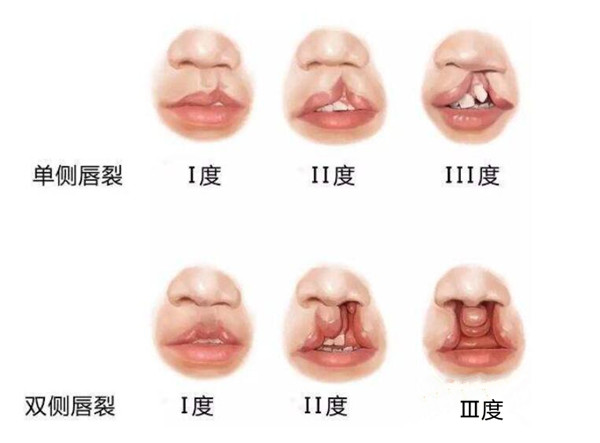 多地篩查活動貼心，方便患者