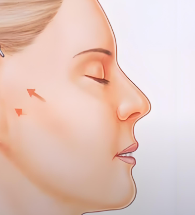 廣州華美林曉燕拉皮手術(shù)怎么樣？