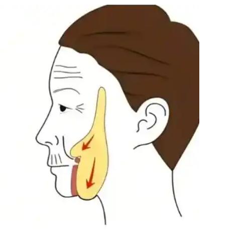 大拉皮術(shù)前