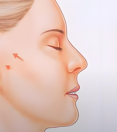 穩(wěn)定期（術(shù)后3 - 6個(gè)月）