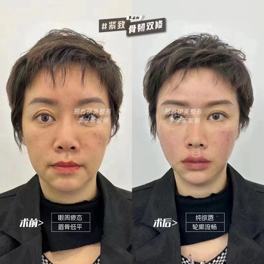 結(jié)語：張路醫(yī)生目前仍在九院，建議通過正規(guī)渠道預(yù)約