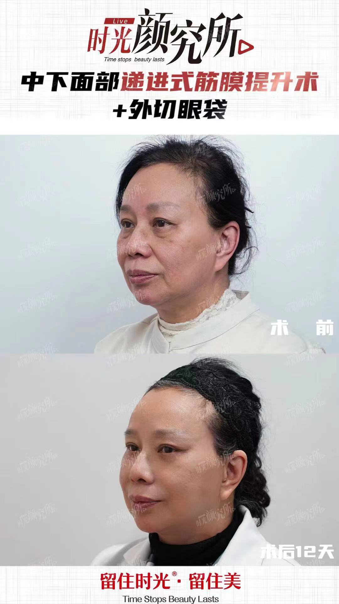 四、服務(wù)體驗(yàn)對(duì)比：貼心與流程化的較量www.sorencai.cn