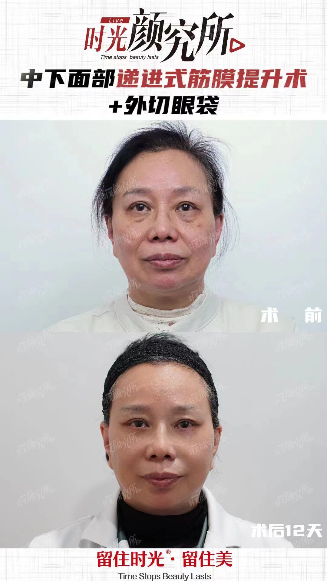 五、費(fèi)用對(duì)比：價(jià)格透明，選擇更安心