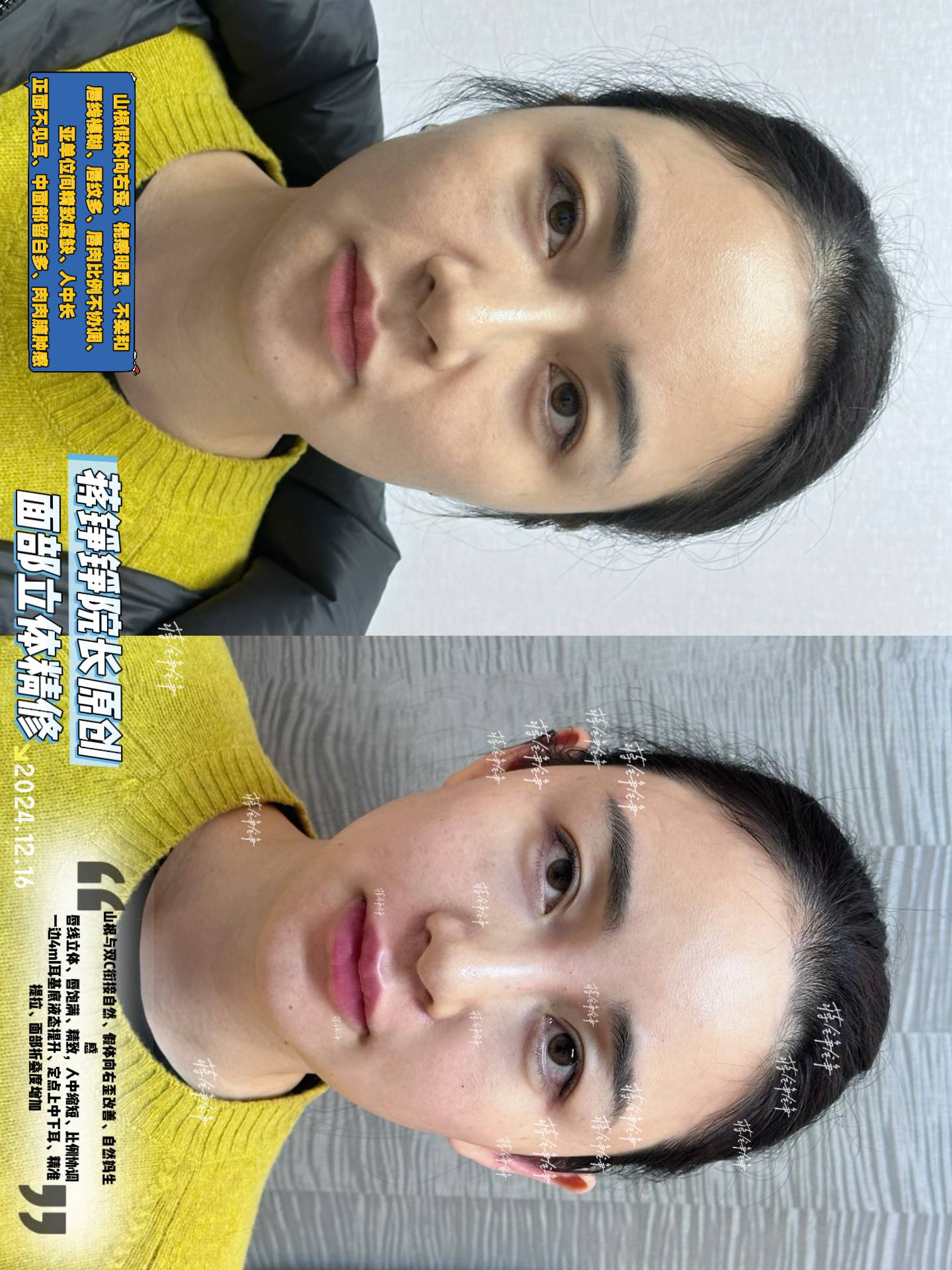 蔣錚錚手術(shù)方案與價(jià)格詳細(xì)解析