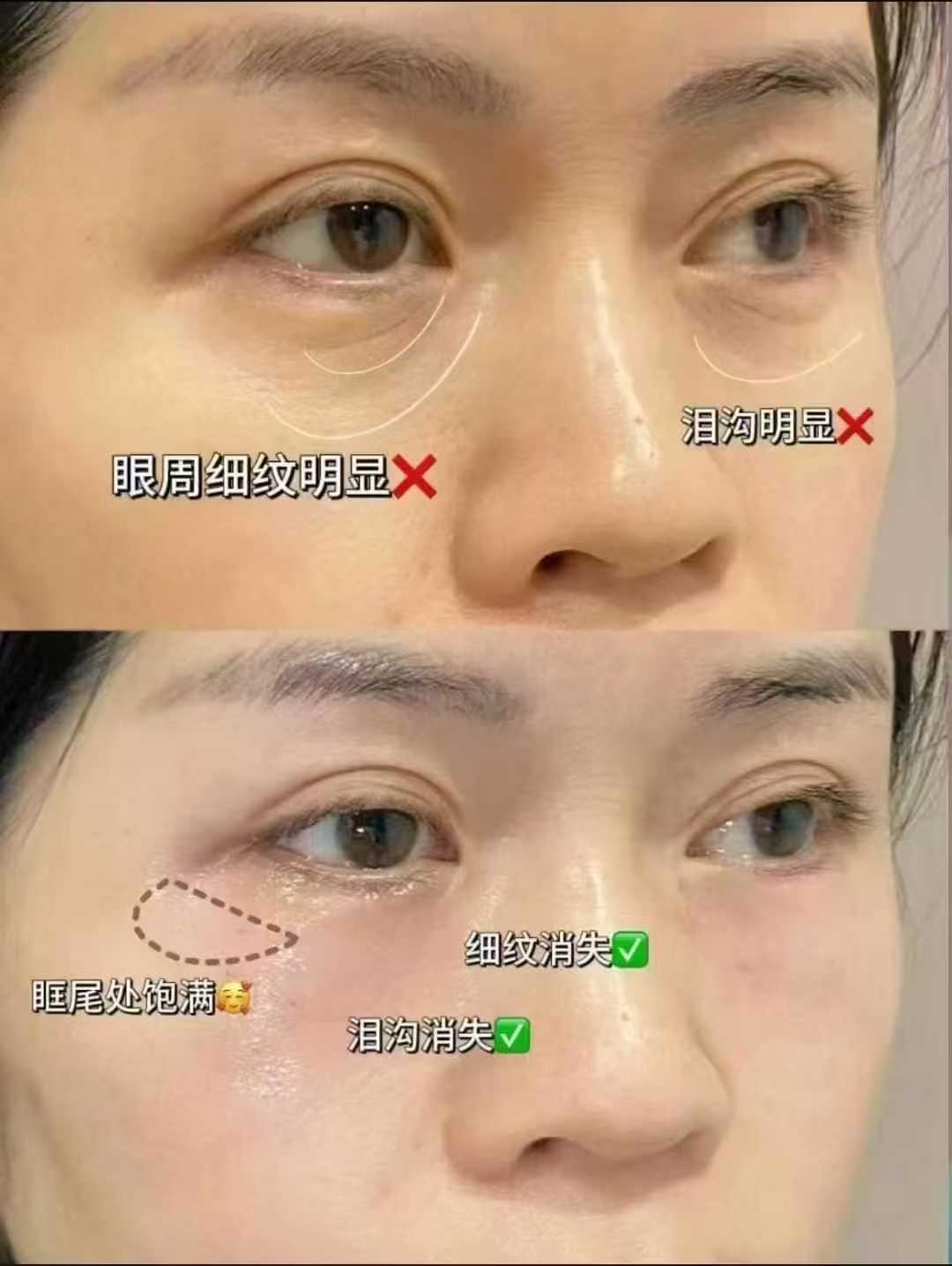 二、技術(shù)對(duì)比：減容 VS 提升，誰更適合你？