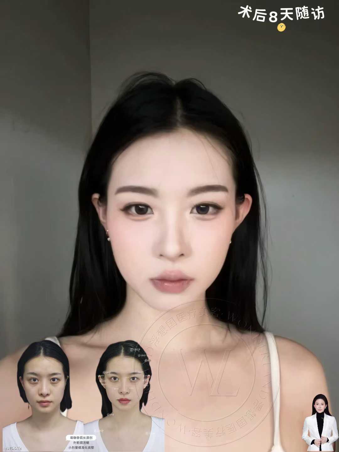 這次整形真的值了！