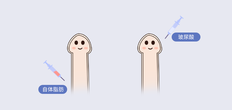 一、龍式延長術(shù)是什么