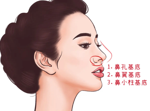 一、找丁昆琨醫(yī)生拉皮的真實反饋www.sorencai.cn