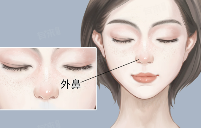 三、拉皮手術(shù)的注意事項與風(fēng)險防范