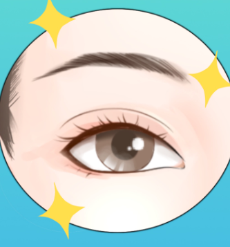 上海于曉雪內(nèi)眼角修復(fù)的成功實例