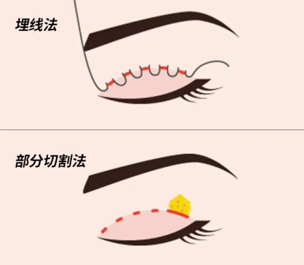 技術(shù)與風(fēng)格特點對比