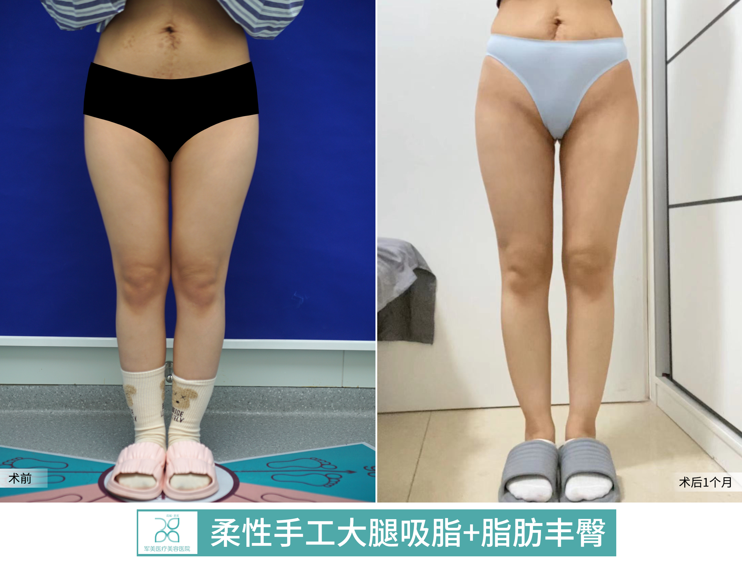 十、深圳曹孟君醫(yī)療美容整形