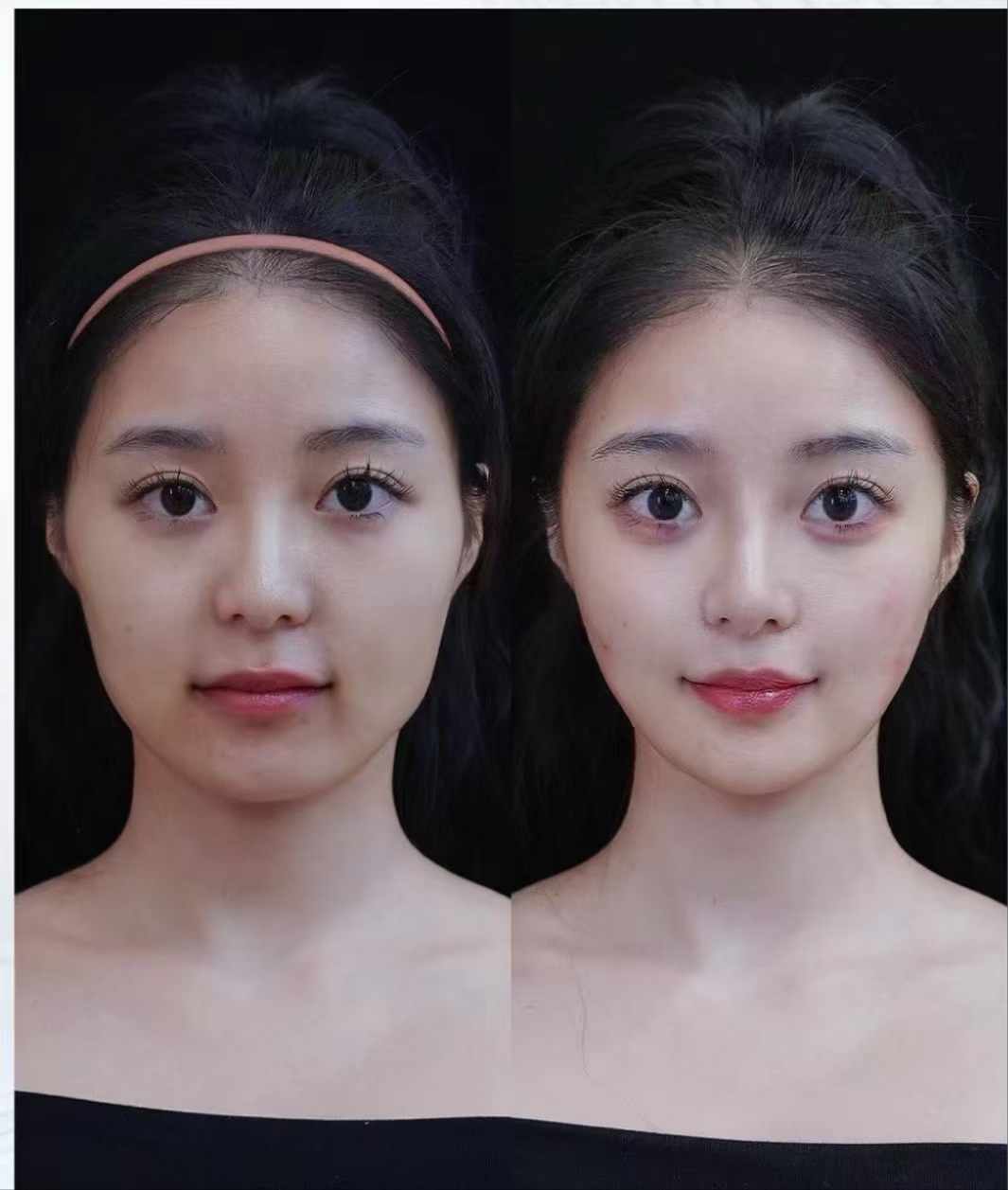 二、杭州蔣錚錚和梁敏雪技術(shù)風格對比：即時驚艷 vs 長效自然