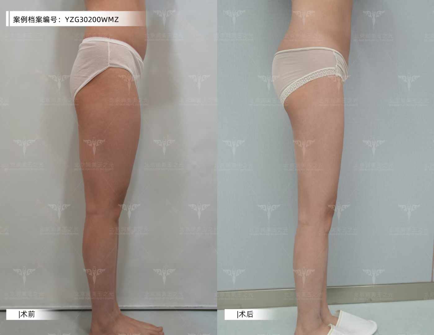 六、上海華美整形醫(yī)院