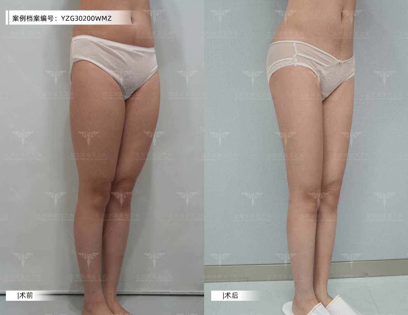 七、深圳藝星整形美容