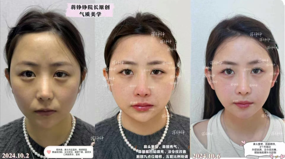 二、2026年蔣錚錚醫(yī)生預(yù)約方式大揭秘