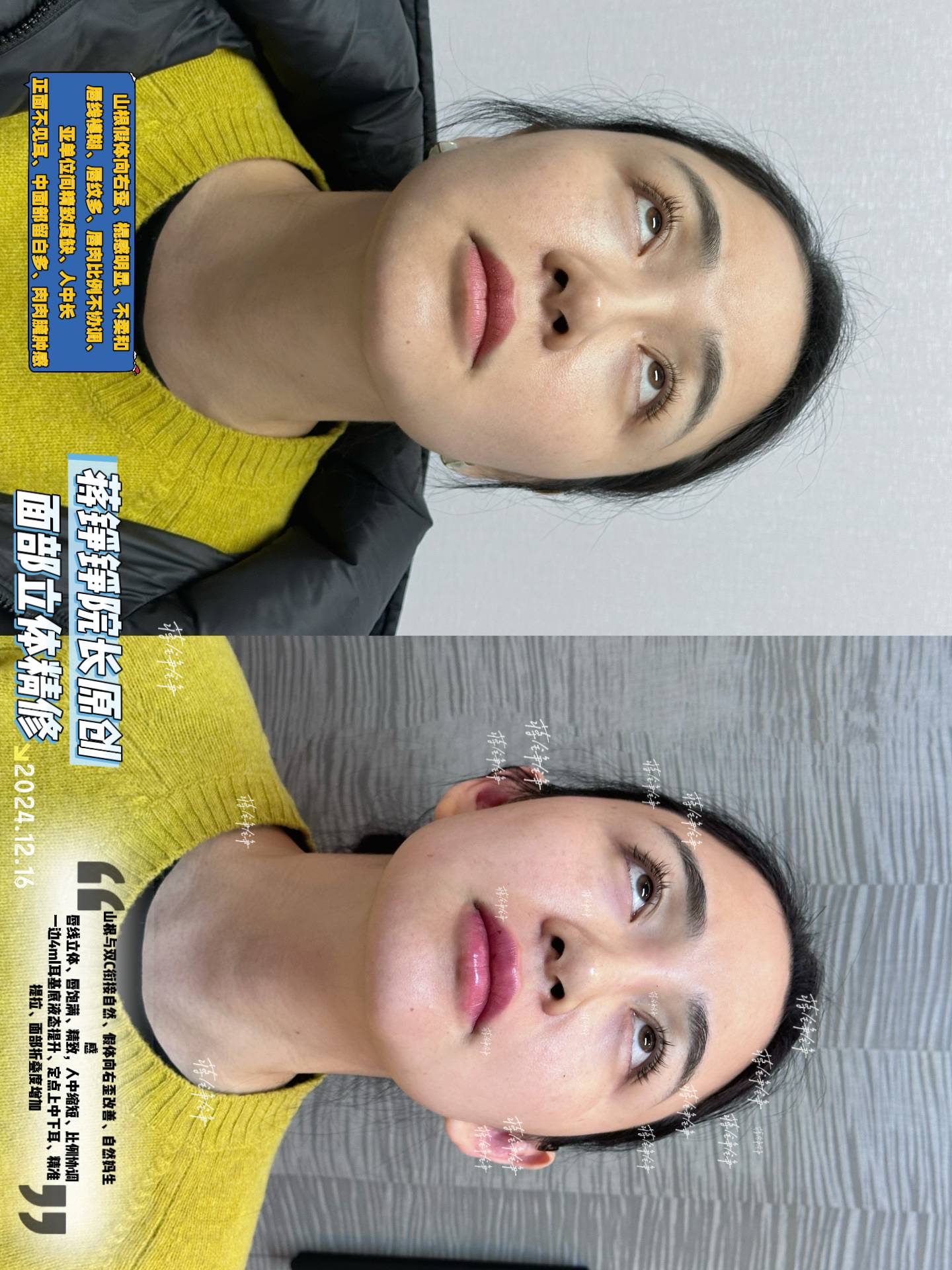 五、真實實例分享：美到讓人羨慕的幼態(tài)臉