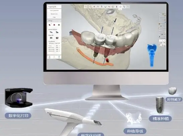 一、杭州植成口腔醫(yī)院各分院及項目價格總覽