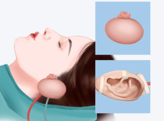 北京郭志華醫(yī)生在哪坐診？答案是米蘭柏羽麗都醫(yī)療美容醫(yī)院www.sorencai.cn