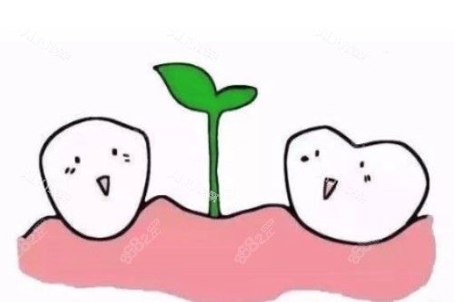 種植牙概念圖 種植牙概念圖