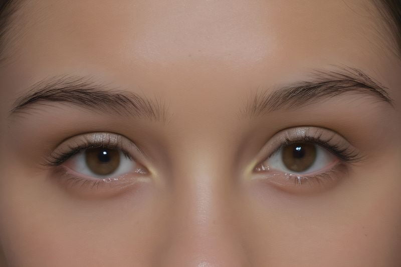 2026廣東省白內(nèi)障手術(shù)免費政策的實施成效與展望