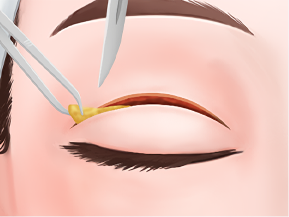 廣州黃俊豪醫(yī)美項(xiàng)目價(jià)格表全新版