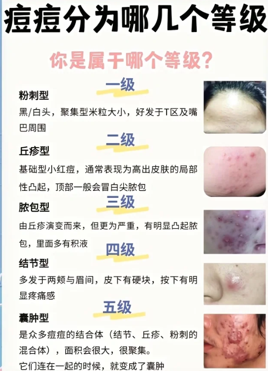 六、半島黃金微針4.0和5.0到術(shù)后修復(fù)與反彈問題