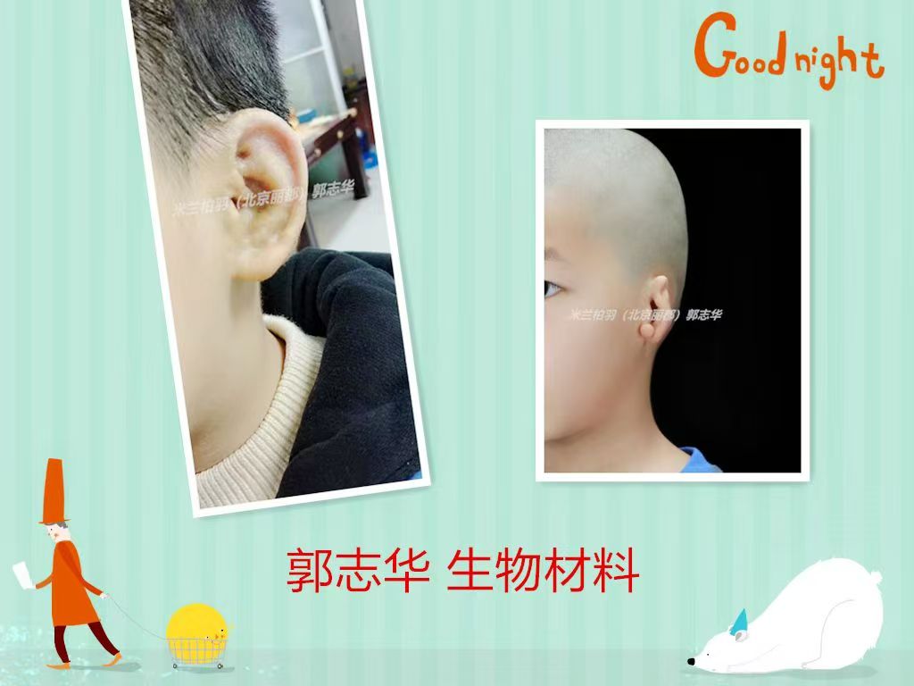 手術(shù)前的準(zhǔn)備