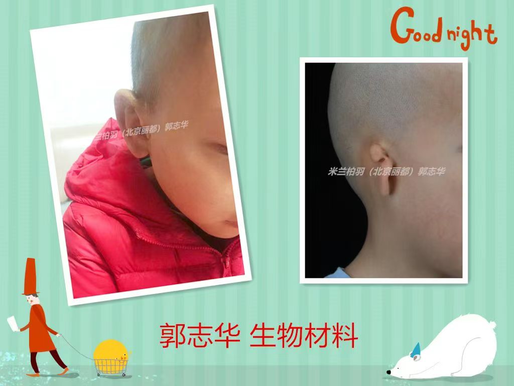 手術(shù)過程詳解