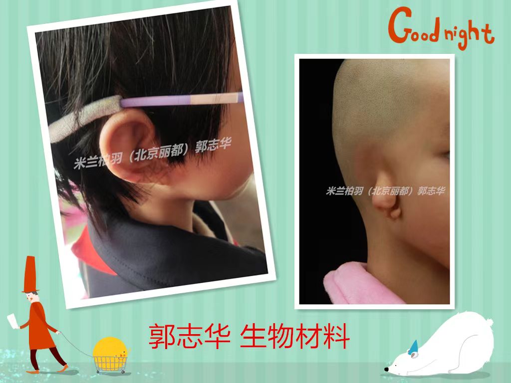 術(shù)后修復(fù)與護(hù)理