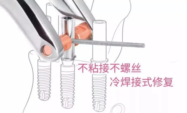 四、杭州植成口腔的綜合優(yōu)勢分析